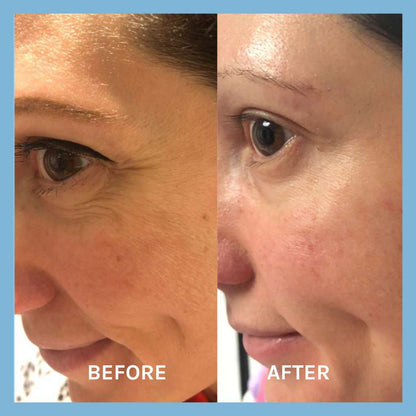 lifting serum before and after results